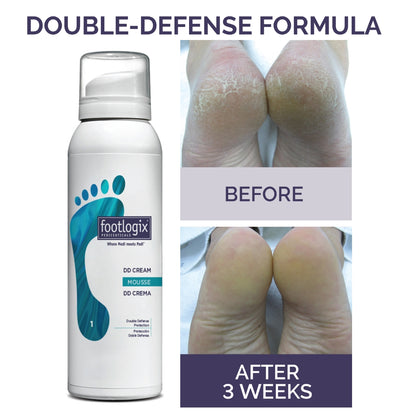MOUSSE DD CRÈME - FOOTLOGIX
