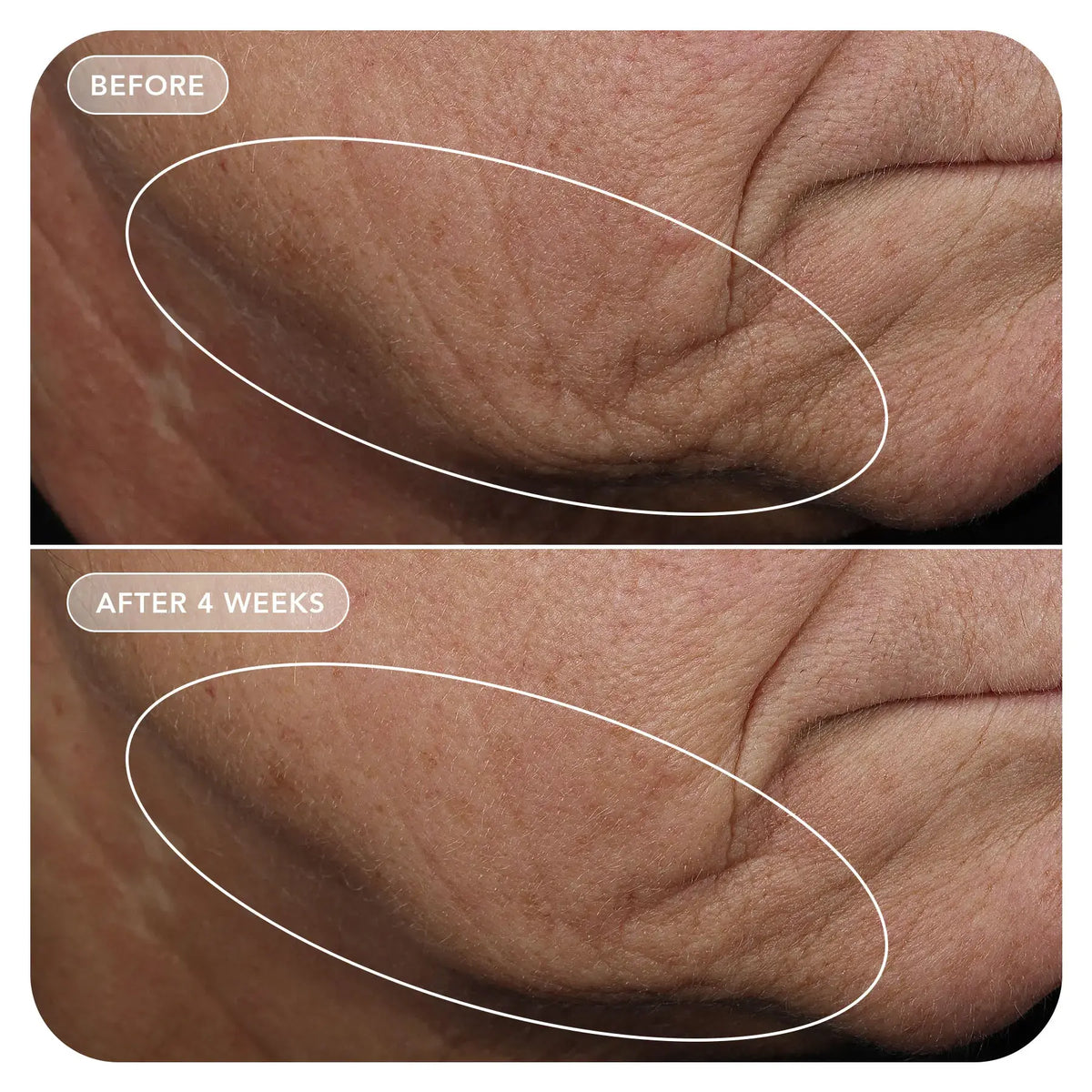 VOL.U.LIFT™ GLP-1 4D complexe repulpant raffermissant