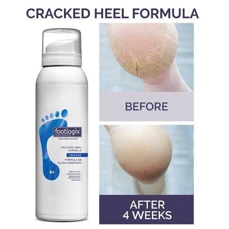 MOUSSE CONTRE LES GERÇURES ET LES CREVASSES - FOOTLOGIX