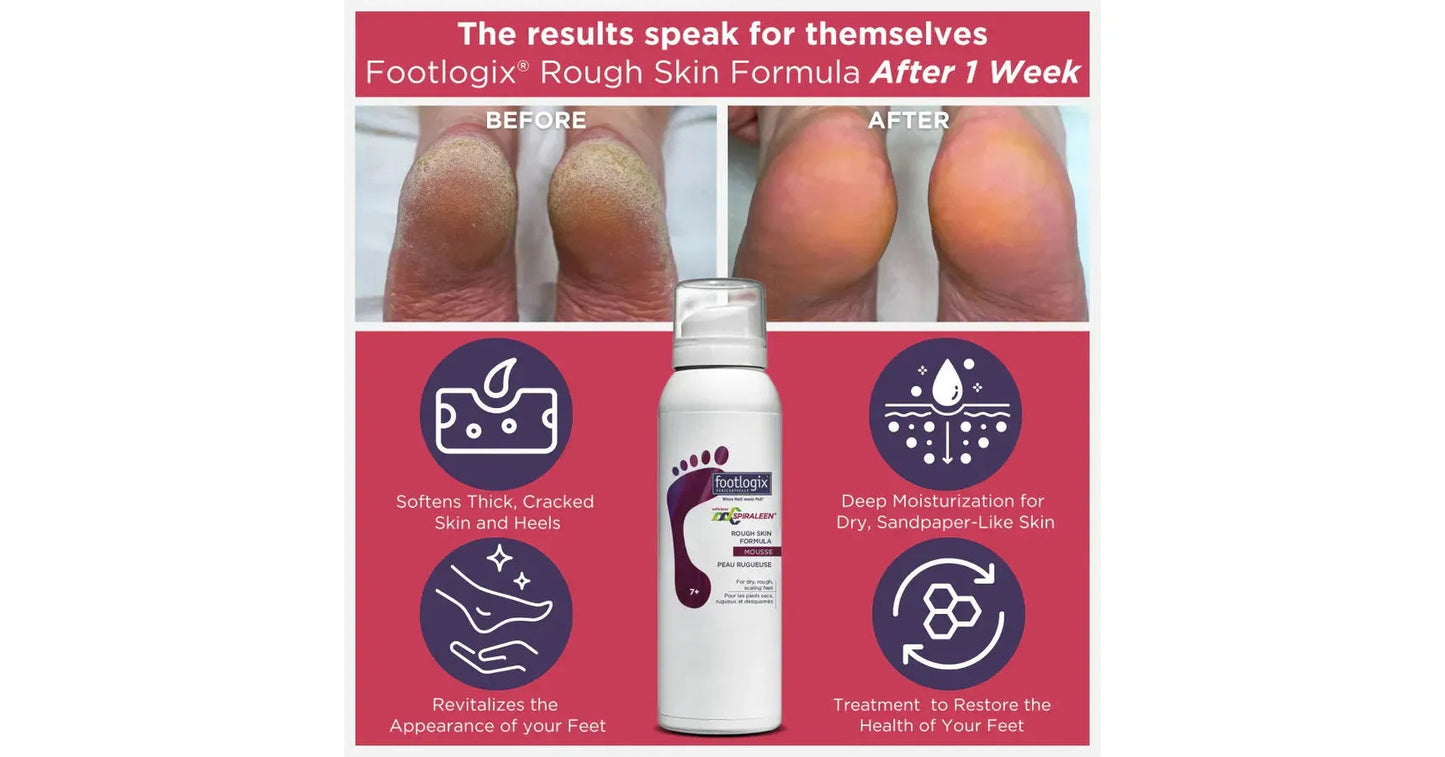 MOUSSE POUR PEAU DESQUAMÉE - FOOTLOGIX